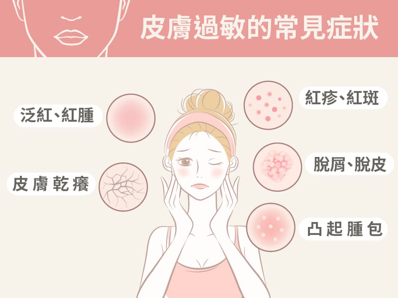 Symptoms of skin allergies