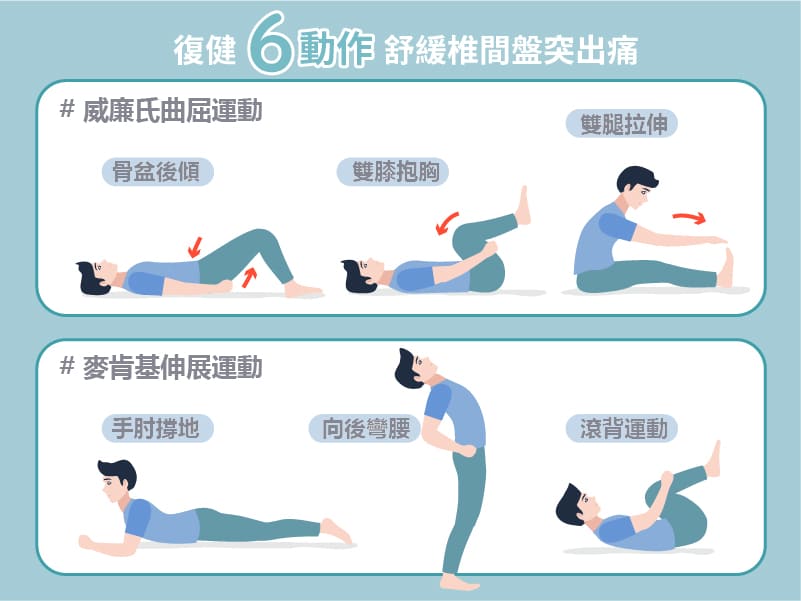 Six rehabilitation exercises you can try to relieve the pain of the herniated intervertebral disc.