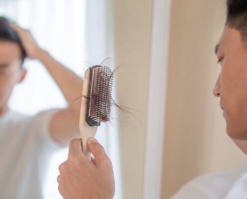 The Asian man notices that he has filled the comb with his fallen hair, which concerns him and raises suspicions about whether he is experiencing male pattern baldness symptoms.
